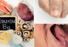 Vitamin B12 Deficiency: The Silent Epidemic You Can’t Afford to Ignore Vitamin B12 Deficiency