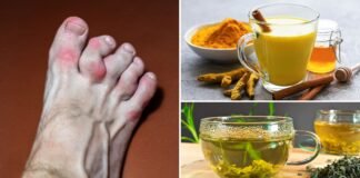 Six Herbal Teas to Lower Uric Acid Levels