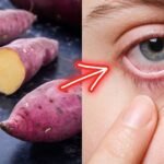 Prevent Cataract: 10 Foods to Help You Maintain Healthy Eyesight Prevent Cataract