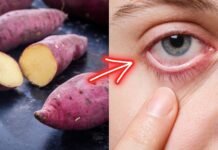 Prevent Cataract: 10 Foods to Help You Maintain Healthy Eyesight Prevent Cataract