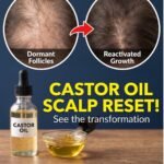 Castor Oil Forces a Scalp Reset by Waking Up Hair Follicles Gone Dormant Castor Oil Forces a Scalp Reset