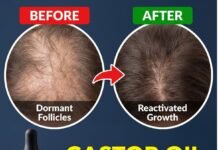 Castor Oil Forces a Scalp Reset by Waking Up Hair Follicles Gone Dormant Castor Oil Forces a Scalp Reset